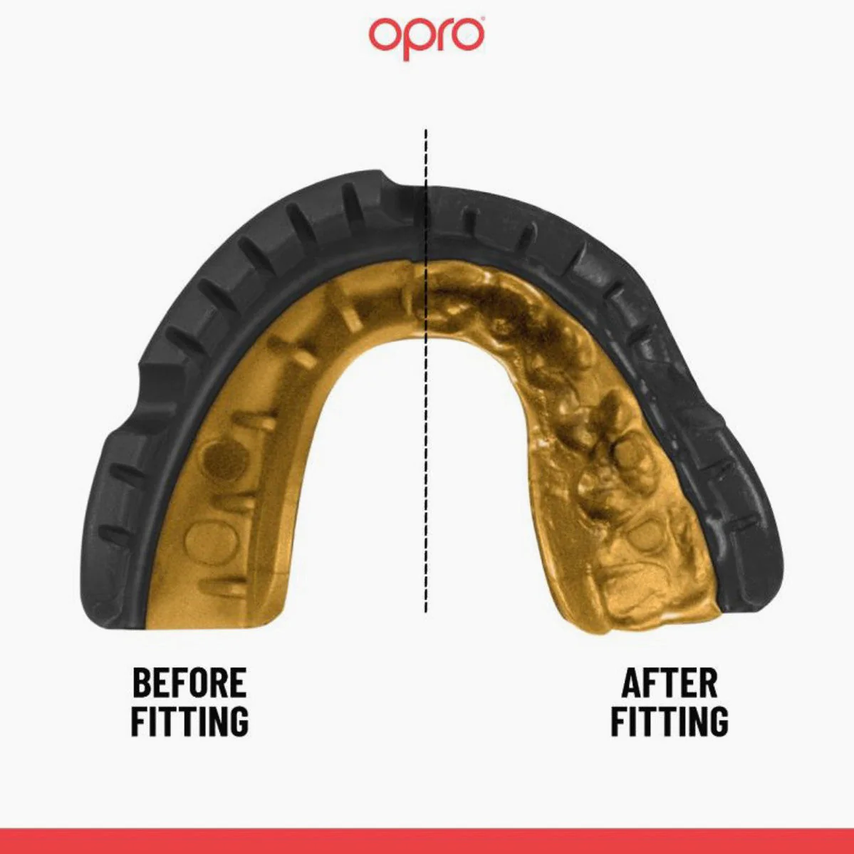 Mouthguard Opro Gold Self-Fit Braces for appliance  - Image 4
